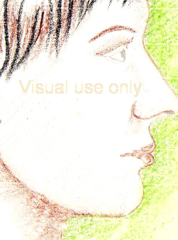 visual use only chin augmentation